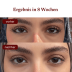 ALYA Wimpernserum